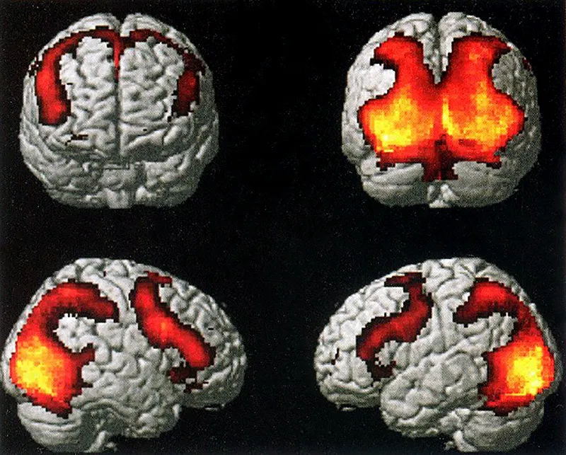 aree-cervello-neuroni-specchio