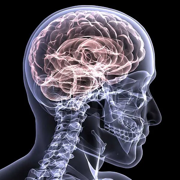 Stimolo elettrico al cervello aiuta le persone colpite da ictus: lo rivela uno studio dell’Università Bicocca